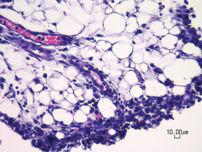 Photomicrograph of a vehicle-treated mouse showing mild to moderate chronic peritonitis characterized by the presence of lymphocytes, plasma cells, and macrophages within peritoneal fat. All animals receiving daily IP injections for 5 days (n=4–9/treatment) exhibited the same finding regardless of treatment with drug or vehicle. Hematoxylin and eosin stain, 400× magnification, scale bar=10 μm. IP, intraperitoneal.