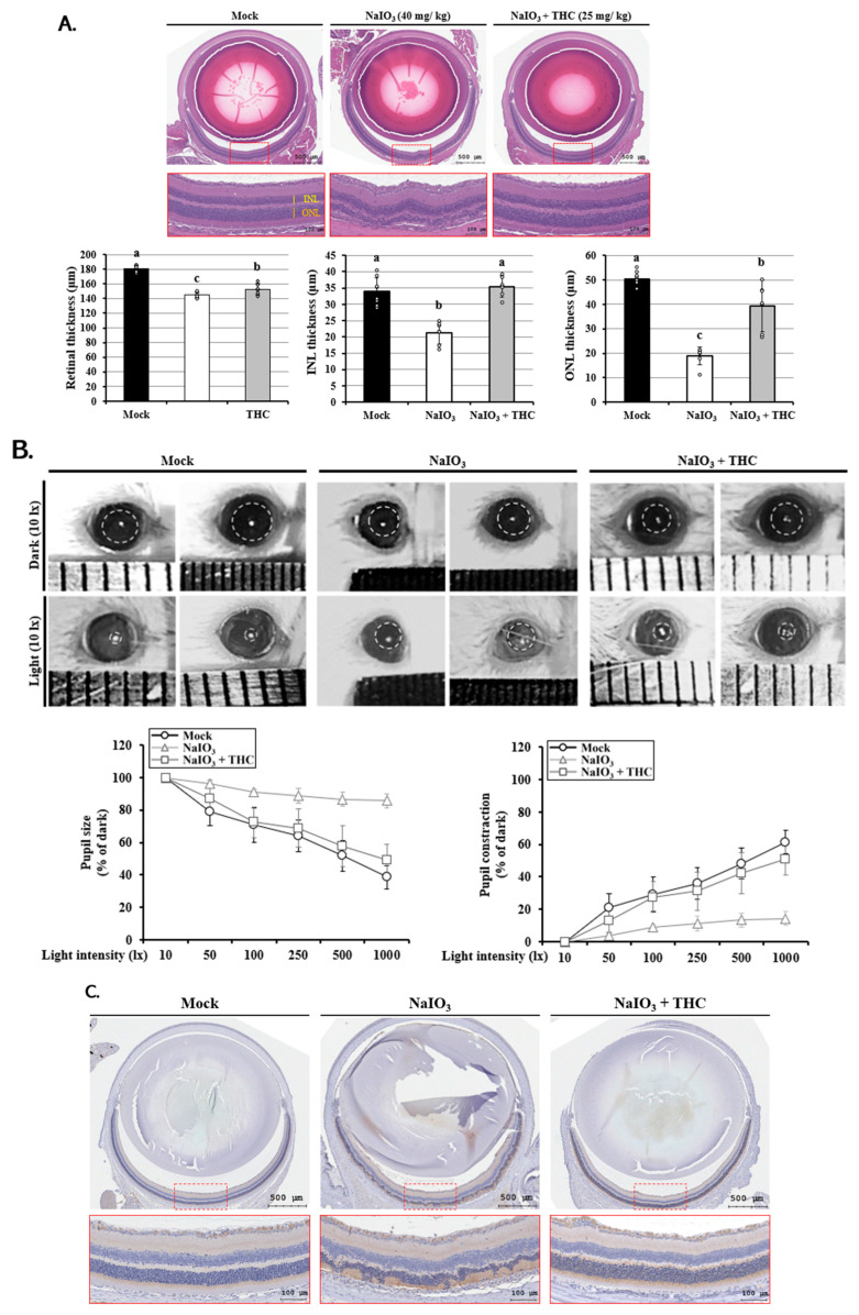 THC attenuates NaIO3-induced retinal degeneration and functional impairment in mice. (A) H&E staining of retinas from the mock, NaIO3-treated, and THC pretreatment + NaIO3 groups. Quantitative analysis of total retinal, inner nuclear layer (INL), and outer nuclear layer (ONL) thickness is shown (n = 6 mice/group). (B) Assessment of retinal function by pupillary light reflex (PLR) analysis. Representative images and quantitative analysis of pupil constriction responses following light stimulation are shown for the mock, NaIO3-treated, and THC + NaIO3 groups (n = 6 mice/group). (C) Immunohistochemical staining of apoptosis marker caspase 3 in retina tissues from the mock, NaIO3-treated, and THC + NaIO3 groups (n = 6 mice/group). Data are presented as the means ± SD of six independent experiments (n = 6). Different letters (a–c) in the statistical graphs indicate significant differences (p < 0.05) within each group.