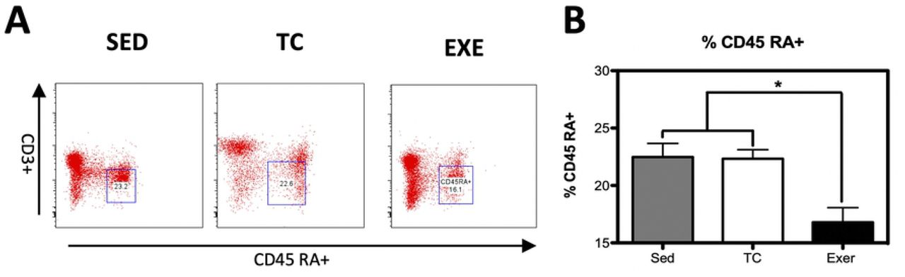 Changes in the composition of B-lymphocytes from spleen.(A) Representative dot plot of the cytometric analysis of the subpopulation percentages. (B) Determination of B-lymphocytes of spleen of rats in the different groups: SED, TC and EXE; data from 4 independent experiments are expressed as mean ± SE. B lymphocytes showed a statistically significant change (ANOVA, p=0.3601, n=10). * Means statistically different from the two other groups, P<0.05.