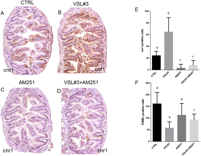 Intestinal distribution of cnr1 by IHC in different experimental groups from ex vivo experimentation: (A) Control; (B) VSL#3; (C) AM251; (D) VSL#3 + AM251. (E) Cnr1 protein levels by IHC and (F) TUNEL positive cell count in the same ex vivo experimental groups. Values indicate mean ± SD. Different letters denote significant differences among groups.