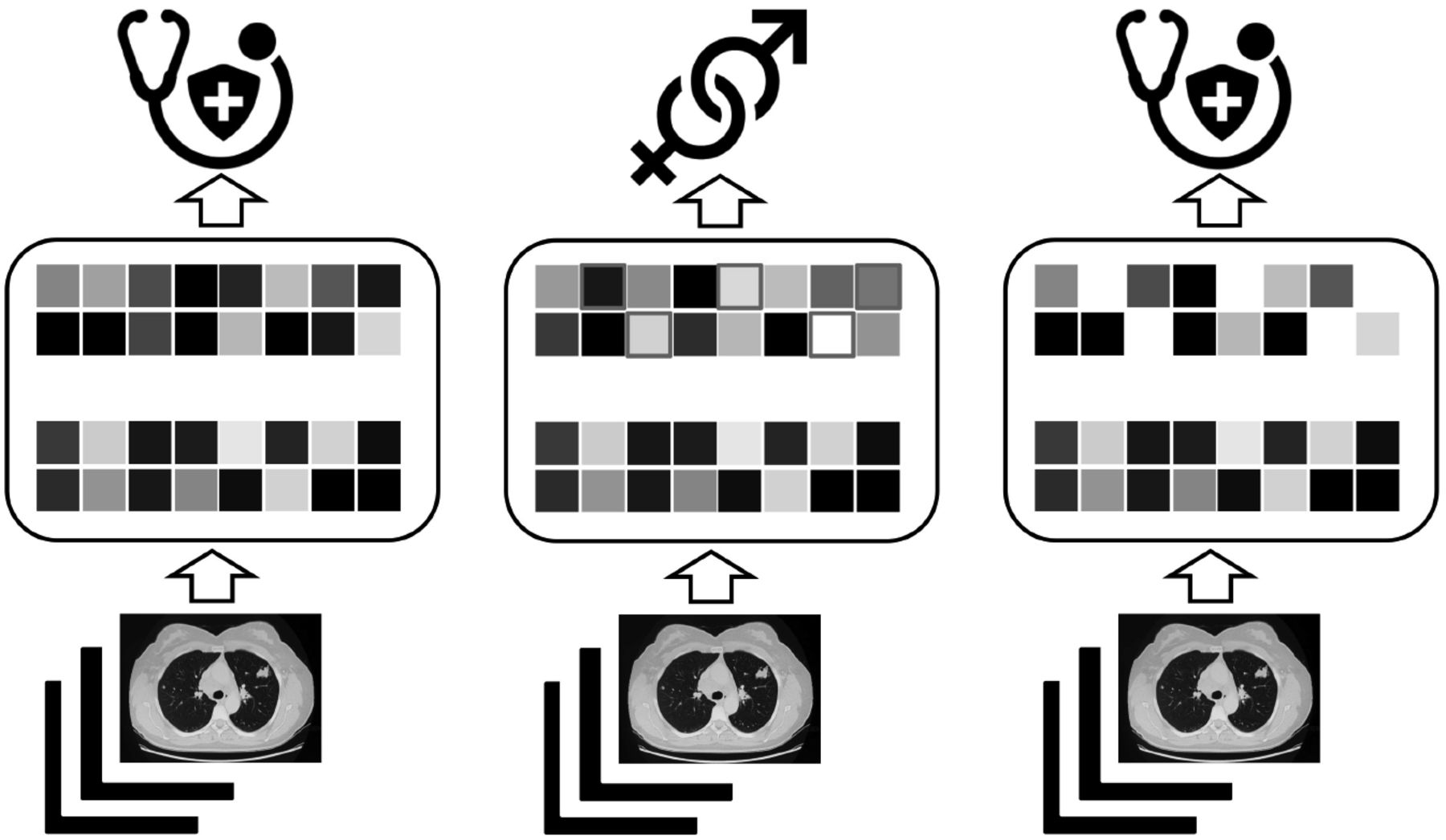 This figure shows the overview of the CF method. From left to right: 1) Train the neural network conventionally. 2) Train the neural network to predict confounding factors (e.g. gender information) and inspect the changes of weights each iteration to locate the ones with largest changes. 3) Remove the located weights, then the model is ready for confounder-free prediction.