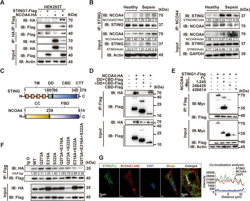 The CDN-binding domain of STING interacts with the CC domain of NCOA4.A Coimmunoprecipitation (Co-IP) of NCOA4 with STING in HEK293T cells. B Immunoprecipitation of anti-STING and anti-NCOA4 in PBMCs from healthy control and patients with sepsis. C Schematic structure of STING and NCOA4 protein. D Flag IP from lysates of HEK293T cells overexpressing Flag-tagged STING fragments and HA-tagged NCOA4 were immunoblotted. E Myc IP from lysates of HEK293T cells overexpressing Myc-tagged NCOA4 fragments and Flag-tagged STING1 were immunoblotted for detection of NCOA4. * Target bands. F Flag IP from lysates of HEK293T cells overexpressing Flag-tagged STING1 mutant plasmids and HA-tagged 1–245 NCOA4 fragments were immunoblotted. G Representative images of co-localization with STING (green) and 1–245 NCOA4 (red) fluorescent proteins were captured by laser scanning confocal microscopy. Enlarged images showed the confocal microscopy images of STING and NCOA4. All immunoblots are representative of at least three independent experiments with similar results. CBD CDN-binding domain, DD dimerization domain, CTT cytoplasmic-terminal tail, CC coiled-coil domain, FBD ferritin-binding domain, FL full-length, IP immunoprecipitation.