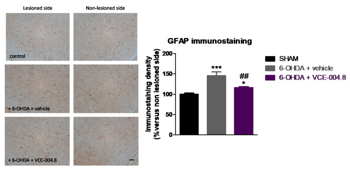 Intensity of the immunostaining for GFAP, a marker of astrocytes, measured in a selected area of the substantia nigra pars compacta of control (sham) mice and unilaterally 6-OHDA-lesioned animals treated with VCE-004.8 (20 mg/kg) or vehicle (Maisine CC/corn oil) given orally. Treatments were daily and prolonged for 2 weeks. Data corresponded to percentage of the ipsilateral lesioned side versus contralateral non-lesioned side at 24 h after the last dose and were expressed as means ± SEM of more than 5 animals per group. They were analyzed by one-way ANOVA followed by the Bonferroni test (* p < 0.05, *** p < 0.005 versus sham; ## p < 0.01 versus 6-OHDA + vehicle). Representative immunostaining images for each experimental group are shown in the left panels (scale bar = 50 µm).