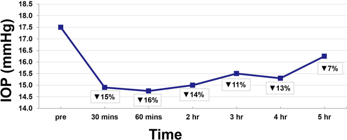 Average IOP reduction over time.