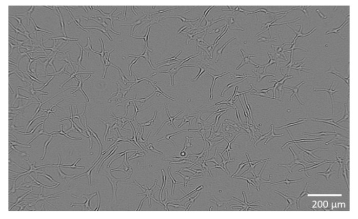 Normal human epidermal melanocytes during cultivation.