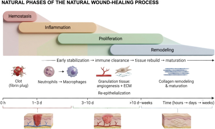 Schematic representation of the overlapping and sequential phases of the natural wound-healing process. The figure illustrates the dynamic progression from hemostasis and inflammation to proliferation and remodeling, highlighting the temporal and cellular interplay among key events such as clot formation, immune cell infiltration, angiogenesis, extracellular matrix deposition, and tissue maturation. Created in BioRender. de Avila, E. (2026) https://BioRender.com/dlw1s68. License: VQ29EDBNCG.