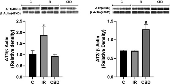 Western blot analysis (A) for AT1 receptor (40 kDa) and (B) for AT2 receptor (36 kDa), in left ventricle of rats submitted to surgery simulation (C), ischemia surgery for 45 min and subsequent reperfusion and those treated with CBD doses of 5 mg/kg c/24 h IP, 10 days prior to the ischemia‐reperfusion procedure. A representative western blot is shown above each graph. The intensity of the bands was quantified by densitometric analysis and normalized with the corresponding β‐Actin (47 kDa). The values are averages ± SEM (n = 3). (A) *p < .05 IR versus C and CBD; (B) *p < .05 CBD versus C and IR