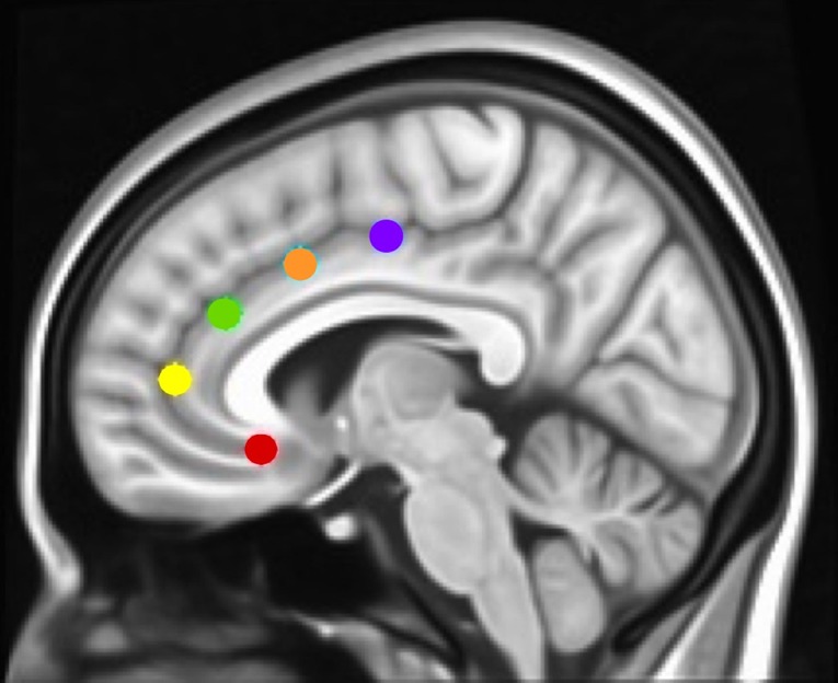 Montreal Neurological Institute (MNI) sagittal view showing anterior cingulate cortex (ACC) seeds. Using the same methods as in Margulies et al. and Kelly et al. (17, 42), and our studies [Camchong et al., e.g., Refs. (27, 45, 46)], we examined the rsFC (resting-state functional connectivity) of five bilateral seed regions of interest (ROIs) located along the ACC: caudal ACC (blue; MNI coordinates: x = ±5, y = 10, z = 47), dorsal ACC (cyan; x = ±5, y = 14, z = 42), rostral ACC (green; x = ±5, y = 34, z = 28), perigenual ACC (yellow; x = ±5, y = 47, z = 11), and subgenual ACC (red; x = ±5, y = 25, z = 10). Each spherical seed covered 257 voxels in 1 × 1 × 1mm space with a radius of 3.5 mm with left and right hemispheres combined.