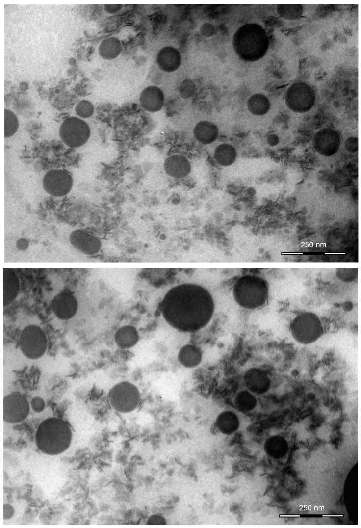Pictures of K-NLCs obtained by transmission electron microscopy. Scale bars = 250 nm.