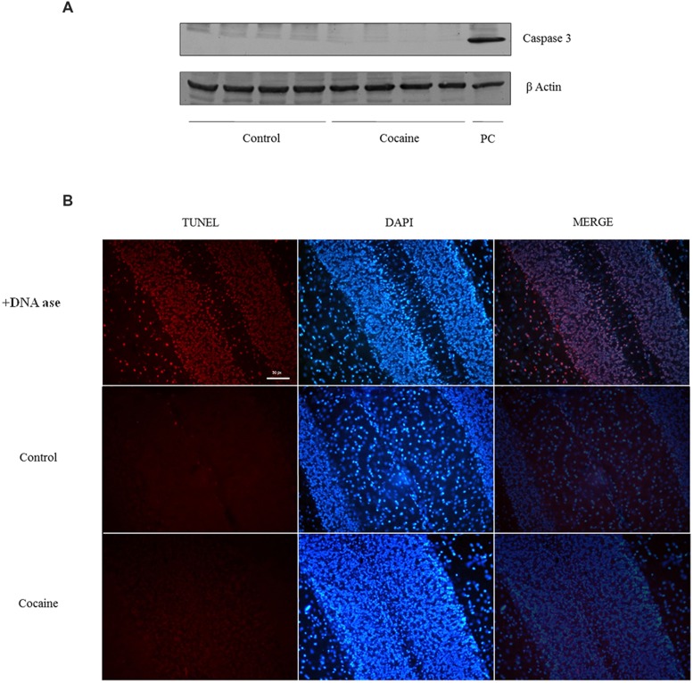 Caspase-3 (17/19 kDa) and β-Actin (42 kDa) western blot analysis in cerebellum (A; Ba/F3 cells were used as positive control of caspase 3 activation). TUNEL assay on cerebellum: +DNA ase reaction (used as positive control of TUNEL) exhibits profuse TUNEL-positive cell labeling (red dye). Minimal or null TUNEL-positive labeled cells could be demonstrated in control or cocaine-treated cerebellar samples (B).