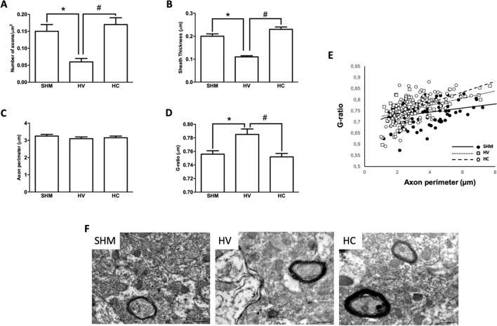 Myelin study in cerebral cortex by electron microscopy Electron microscopy studies performed in the parieto-occipital cortex 30 days after a hypoxic-ischemic (HI) insult induced in P7–10 Wistar rats then receiving vehicle (HV) or cannabidiol (HC), or a similar period in control rats (SHM). (A) Number of axons (B) myelin sheath thickness (C) Axon perimeter (D) g-ratio (E) Dots and trend lines representing the relationship between axon size and g-ratio values (F) Representative micrographs. Bars represent mean ± SEM. Scale bar: 10 µm. *p < 0.05 vs SHM; #p < 0.05 vs HV), by ANOVA.