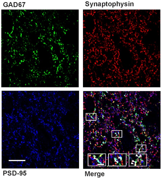 Immunohistochemical triple stainings to quantify excitatory synapses on GABAergic neurons in lamina II of the spinal dorsal horn.Confocal images depicting co-staining of GAD67 (green) with the postsynaptic marker PSD-95 (blue) and the presynaptic marker synaptophysin (red). Bottom right, white arrowheads in enlarged boxed areas indicate colocalization of the three antigens. Scale bars: 10 µm (2 µm for enlarged boxes).