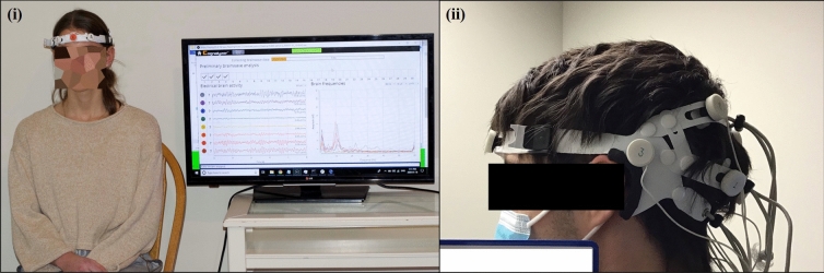 (i) Photograph of a model participant undergoing a Cognalyzer® test. (ii) Photograph of Cognalyzer® electrode placements on a study participant. The study participant has given us permission for their photo to be used in the publication
