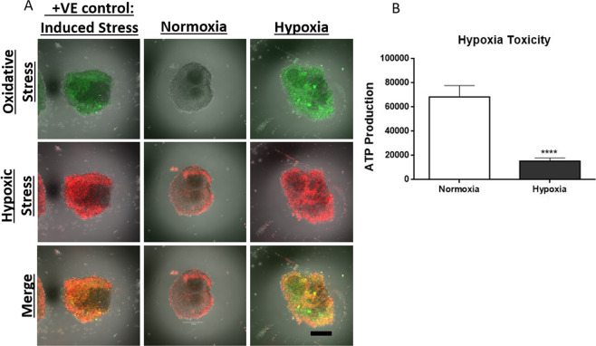 Hypoxia induces oxidative stress. In (A), 10 organoids in each in each of the three group were pooled and cultured under hypoxic conditions and normoxic culture conditions. The positive control was prepared by treating the normoxic organoids with oxidative stress inducer, Pyocyanin and hypoxic inducer, Deferoxamine. All groups were then incubated in hypoxic and oxidative stress detection reagent that reacts with oxidative stress mediators to produce a fluorescent product. Images were obtained using a confocal microscope. Qualitative results show more hypoxic (Red) and oxidative stress (Green) in organoids cultured under hypoxia. In (B), metabolic activity was assessed by measuring ATP production. There was a significant decrease in ATP production in hypoxic organoids. Student T-Test, two tailed hypothesis, n = 40 organoids per group in B, ****P < 0.0001. Data represented as mean \documentclass[12pt]{minimal} \usepackage{amsmath} \usepackage{wasysym} \usepackage{amsfonts} \usepackage{amssymb} \usepackage{amsbsy} \usepackage{mathrsfs} \usepackage{upgreek} \setlength{\oddsidemargin}{-69pt} \begin{document}$$\pm \,{\rm{SEM}}$$\end{document}±SEM. Scale bars 250 μm.