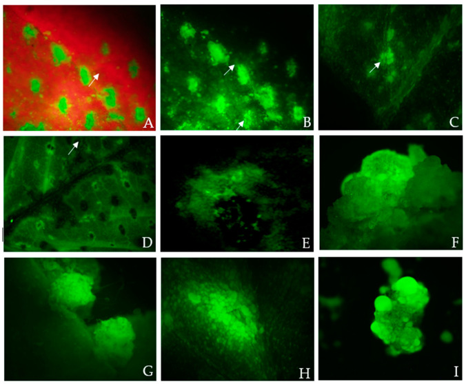 GFP protein fluorescence in Cannabis sativa L. wounded fully expanded 3-week-old leaf explants and leaf-derived embryogenic calli co-cultivated for 3 days with Agrobacterium suspension at final OD600nm of 0.6 and washed 5× times with Murashige and Skoog washing medium before capturing the images using an Olympus SZX12 Stereo Fluorescence Microscope (Olympus America Inc., Melville, NY, USA). White arrows indicate GFP gene expression. The images were obtained using the fluorescence microscope mounted with a long-pass GFP filter and a DP72 camera. The GFP filter had excitation wavelengths of 460 to 480 nm and emission wavelengths of 495 to 540 nm, and the GFPA filter for the separation of GFP and blue-excited fluorophores had excitation wavelengths of 460 to 490 nm and emission wavelengths of 510 to 550 nm; these were used to identify the leaf and embryogenic callus tissues expressing GFP. (A,B) show the corresponding fluorescence image of 3-week-old fully expanded wounded leaves (cluster of cells) exhibiting GFP fluorescence and chloroplast autofluorescence, captured using a stereo fluorescence microscope under a GFP filter. The leaf tissues displayed green fluorescence that was partially masked by red fluorescence from chlorophyll (scale bar = 500 µm). (C) GFP protein fluorescence within the clusters of multiple cells in the leaf tissue (scale bar = 300 µm, GFPA filter); (D) strong expression of the GFP gene in primary vascular structures 3 days after co-cultivation (arrow); (E) strong expression of the GFP gene in the multiple isolated cells; (F,G) three-week-old leaf-derived callus pieces grown in a non-selection medium expressing GFP (globular embryos) (scale bar = 500 µm); (H) transformed globular-shaped embryogenic calli grown in a non-selection medium showing GFP expression (scale bar = 500 µm); (I) transformed nodular calli grown in the selection medium (10 mg/L hygromycin) showing GFP expression on day 14. (D,E,I) Magnification = 10 × 40.