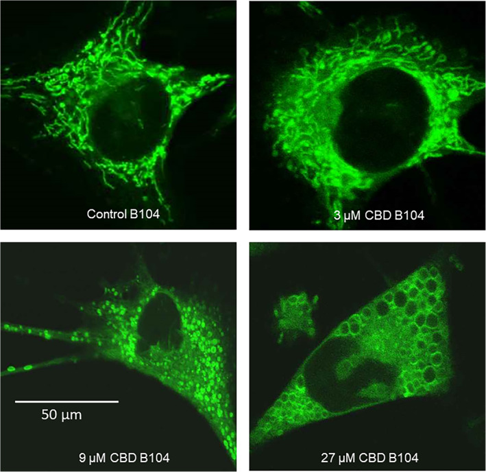 Effects of CBD on mitochondrial structure in animal cells. B104 are a mouse neuroblastomacell line. Mitochondria were visualised using Mitotracker© green after 3 hours. The images are typical cells taken at high magnification using an oil lens. At 3 µM CBD induces formation of small loop structures, with some evidence of fusion and the formation of donuts, characteristic of an initial stress response. At 9 µM it induces fission, with evidence of some mild mitochondrial swelling. At 27 µM it seems to be inducing massive mitochondrial swelling. This can be partly explained by modulation of calcium flux, and in part, could be related to the effects of CBD on VDAC1. This is data taken from the authors published abstract (referenced in main text)