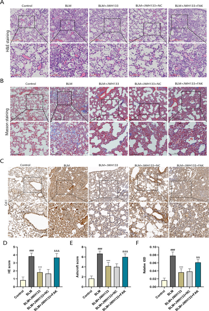 Pathological changes of lung tissue in mice treated with JWH133. (A) H&E staining of mouse-lung tissue in control.Scale bar: 250 μm and 100 μm. (B) Masson staining of mouse-lung tissue in control.Scale bar: 250 μm and 100 μm. (C) Immunohistochemistry images of mouse-lung tissue in control.Scale bar: 100 μm and 50 μm (D) HE staining score for each group.n = 6. (E) Ashcroft score for each group.n = 6. (F) Relative IOD for each group.n = 5.###P < 0.001 vs. control group;***P < 0.001 vs. model group; &&P < 0.01,&&&P < 0.001 vs. BLM + JWH133 + NC.