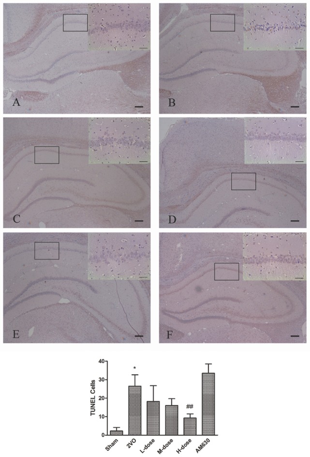 TUNEL staining showed the effects of HPβCD/BCP on apoptosis in hippocampal neurons caused by 2VO: sham group (A), 2VO group (B), HPβCD/BCP low dose group (C), HPβCD/BCP middle dose group (D), HPβCD/BCP high dose group (E), and AM630 group (F). The TUNEL positive cells in the 2VO group significantly increased in the CA1 region of hippocampus compared with the sham group. After HPβCD/BCP treatment, the number of TUNEL positive cells was obviously suppressed. And AM630 aggravated apoptosis in the hippocampus compared with the 2VO rats. The bar is 100 μm (*P < 0.001 vs. sham group, ##P < 0.001 vs. 2VO group).