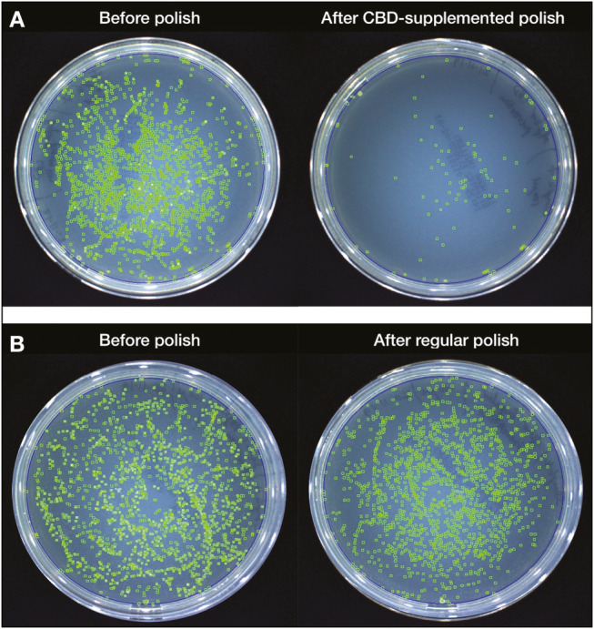 Sample pictures of bacterial culture plates representing bacterial colonies (A) before vs after CBD-supplemented air polishing, (B) before vs after regular air polishing. The green color highlights are generated by using an automated colony counter, and each green mark represents a single bacterial colony detected by aCOLyte3