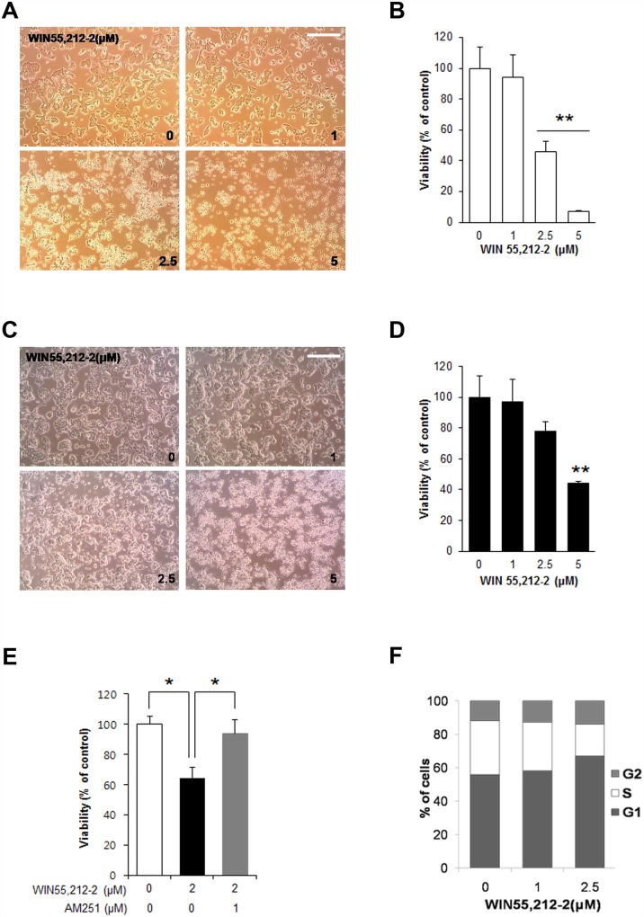 The synthetic CB1R agonist WIN55,212–2 leads to decreased cell viability and increased G1 arrest in pancreatic β-cell lines.(A) Representative images of MIN6 cells exposed to WIN55,212–2. Scale bar, 50 μm. (B) The relative cell viability of MIN6 cells was determined by MTS assay 24 h after treatment with WIN55,212–2. Scale bar, 50 μm. (C) Representative images of βTC6 cells exposed to WIN55,212–2. (D) The relative cell viability of βTC6 cells was determined by MTS assay 24 h after treatment with WIN55,212–2. (E) The relative cell viability of MIN6 cells exposed to WIN55,212–2 with or without a CB1R inverse agonist AM251. MIN6 cells were exposed to WIN55,212–2 with or without AM251 for 24 h, and relative cell viability was determined by MTS assay. (F) WIN55,212–2 treatment in βTC6 cells increases the proportion of cells in G0/G1 phase. βTC6 cells exposed to WIN55,212–2 for 24 h were analyzed using a fluorescence activated cell sorter (FACS). Data are shown as the mean ± SEM from three independent experiments. *P< 0.05; **P< 0.01.