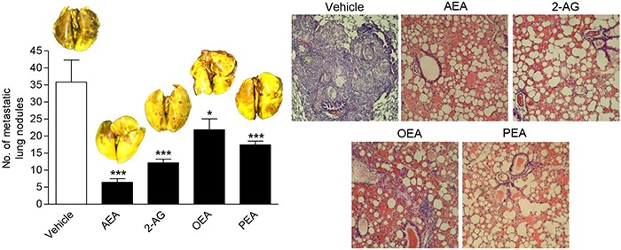 Impact of FAAH substrates on lung metastasis in nude miceA549 cells were injected intravenously in athymic nude mice. Mice were given intraperitoneal injections of AEA, 2-AG, OEA and PEA every 72 h for 28 days starting 24 h after injection of the cells. For all test substances, the initial dose (first administration) was 10 mg/kg followed by subsequent treatments with 5 mg/kg. Complete lungs of animals sacrificed one day thereafter were evaluated for metastatic nodules after fixation in Bouin's fluid. Images above the histogram indicate Bouin's fluid-stained lungs; images besides the histogram indicate hematoxylin/eosin stainings of paraffin sections from lungs. Values are means ± SEM of n = 6 - 7 animals per group. *P < 0.05, ***P < 0.001 vs. vehicle; one-way ANOVA plus post hoc Dunnett test.