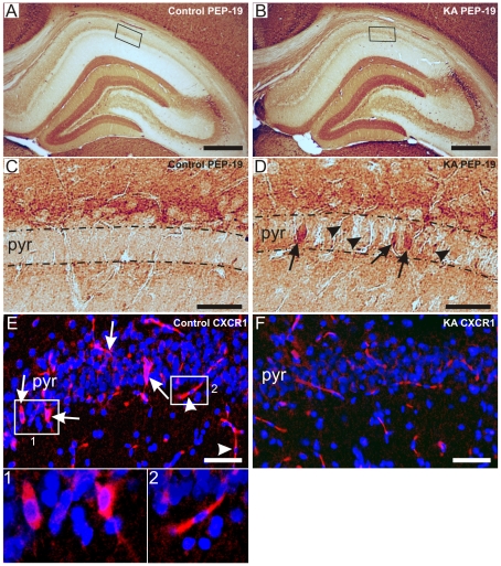 Validation of the microarray results by immunohistochemical staining of PEP-19 and CXCR1 in control and KA-treated rats.Immunoreactivity of PEP-19 in the whole hippocampus in a representative control (A) and KA-treated rat (B). Figs. 6C and Dshow the CA1 region of A and B, respectively, at the higher magnification. Note the lack of PEP-19 immunoreactivity in the CA1 pyramidal layer in the control rat (C), while the staining was weak in the CA1 layer (D, arrowheads), and greatly enhanced in single neurons (D, arrows) in the KA-treated rat. Figs. 6E and Fshow the CXCR1 immunoreactivity in the CA1 region of a control and KA-treated rat. In control rats, immunoreactivity occurred in discrete neurons in the CA1 pyramidal layer (E, arrows and insert 1), and in vascular endothelial cells (E, arrowheads and insert 2). In KA-treated rats, no immunoreactive neurons could be detected (F). Scale bars: 200 µm in A–B, 40 µm in C–D, and 75 µm in E-F. Abbreviations: CXCR1, interleukin 8 receptor; PEP-19, Purkinje cell protein 4; pyr, stratum pyramidale.