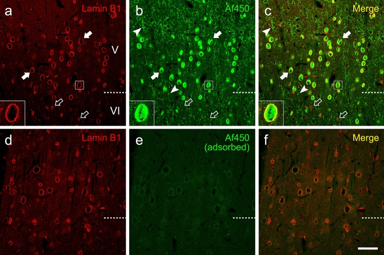 a–c Double immunofluorescence labelling in the adult rat cortex under sodium sulphide fixation combining a mouse monoclonal antibody recognizing the nuclear protein lamin B1 (pseudocoloured red) and the goat polyclonal anti-CB1 antibody Af450 (pseudocoloured green). The anti-CB1 antibody immunostained presynaptic-like boutons (arrowheads) as well as large and medium sized (filled arrows) but not small nuclei (empty arrows), as seen by co-staining with lamin B1. d–f The same experiment depicted in a–c was performed after preadsorption of the anti-CB1 with the immunizing peptide. Images are single 0.5-µm-thick confocal optical sections. Scale bar: 50 µm in f (applies to a–f)