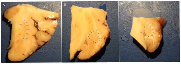 Macroscopic view of the right horse amygdaloid complex in a coronal section at the rostral (A), middle (B), and caudal (C) levels. The lateral nucleus boundary is indicated by the arrows.