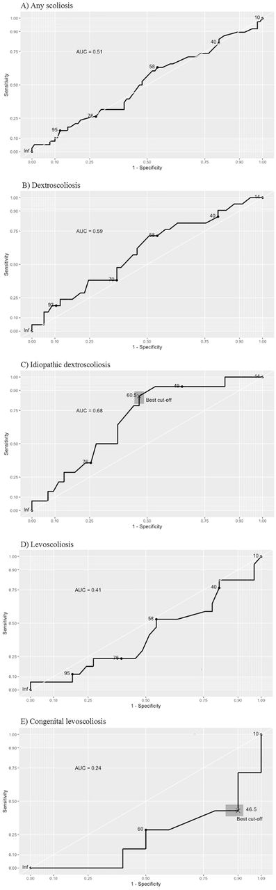 Operator Characteristic Curve (ROC) curve analysis of Cobb angle and spinal cord tethering in A) all scoliosis sample B) dextroscoliosis C) interactive subgroup of idiopathic dextroscoliosis D) levoscoliosis and E) interactive subgroup of congenital levoscoliosis