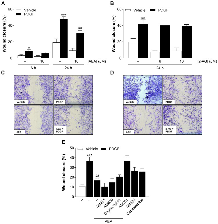 Influence of AEA (A,C,E) and 2-AG (B,D) on basal and PDGF-induced HCASMC migration. Cells were maintained in serum-reduced medium for 24 h before the cell monolayer was scratched in a straight line and then stimulated with 25 ng/mL PDGF or its vehicle and treated with AEA (10 µM), 2-AG (6 µM, 10 µM) or its vehicle. For the analysis of receptor signaling (E), cells were preincubated with the indicated receptor antagonists at 1 µM for 1 h before addition of PDGF and AEA. Light microscopic images of the scratch area were taken with a 5× objective at 0 h, 6 h (only AEA) and 24 h (C,D) after stimulation and after crystal violet staining. The scale bars indicate 200 µm. Data are expressed as means ± SEM of n = 8–11 (4–5 independent experiments, (A)), n = 6 (3 independent experiments, (B)) or n = 8 (4 independent experiments, (E)). * p ≤ 0.05, ** p ≤ 0.01, *** p ≤ 0.001 vs. PDGF-free vehicle control; ## p ≤ 0.01 vs. PDGF control; one-way ANOVA plus Bonferroni post hoc test.