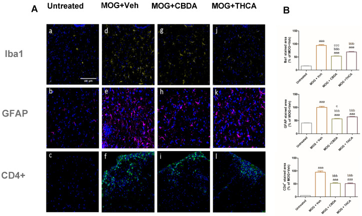 Effect of CBDA or THCA on glial activation and CD4+ T cell infiltration in the lumbar spinal cord. (A) Representative confocal images of lumbar spinal cord sections stained for microglia (Iba1; panels (a,d,g,j)), astrocytes (GFAP; panels (b,e,h,k)), and CD4+ T cells (CD4; panels (c,f,i,l)). Cell nuclei were counterstained with DAPI (blue). Images were acquired at ×40 magnification. Sections were 30 μm thick. The data are representative of two independent experiments; 3–4 sections were analyzed per mouse (n = 6 per group). (B) Quantification of Iba-1, GFAP, and CD4 immunoreactivity. Data are presented as means ± SEM and were analyzed using ImageJ software. Statistical analysis was performed using one-way ANOVA followed by Tukey–Kramer multiple comparisons post hoc test. aaa: p < 0.001 vs. control, bbb: p < 0.001 vs. MOG + Veh, ccc: p < 0.001 vs. MOG + THCA.