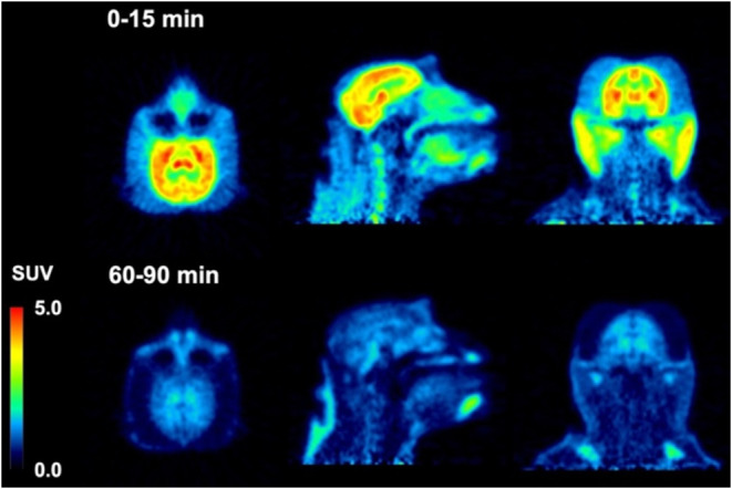 PET Images of [18F]75 in a male rhesus macaque (13 kg).