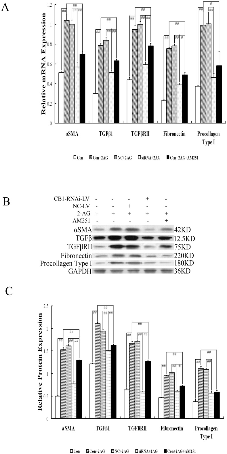 Effect of CB1-RNAi-LV on activation and ECM production of primary hepatic stellate cells.(A) The statistical results of α-SMA, TGF-β1, TGF-β RII, fibronectin and procollagen type I mRNA expression in HSCs (named Con), HSCs with 2-AG (named Con+2AG), HSCs with NC-LV and 2-AG (named NC+2AG), HSCs with CB1-RNAi-LV and 2-AG (named siRNA+2AG), HSCs with 2-AG and AM251 (named Con+2AG+AM251) by RT-PCR analysis. Relative expression levels of mRNA were normalized against those of GAPDH mRNA. (B) shows representative graphs of α-SMA, TGF-β1, TGF-β RII, fibronectin and procollagen type I protein expression by Western blot analysis and (C) shows the statistical results. Results demonstrated that the mRNA and protein expressions of α-SMA, TGF-β1, TGF-β RII, fibronectin and procollagen type I in HSCs were all increased significantly after 2-AG stimulation, which were all decreased significantly when stimulated with AM251 or transfected with CB1-RNAi-LV. Furthermore, the mRNA expression of α-SMA, TGF-β1, TGF-β RII and fibronectin in HSCs stimulated by 2-AG and AM251 was higher significantly than that in HSCs stimulated by 2-AG and transfected with CB1-RNAi-LV. “#” p<0.05, “# #” p<0.01.