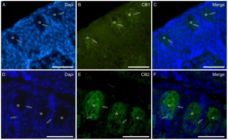 Photomicrographs showing cryosections of the piglet papilla vallata (A–C) and papilla foliata (D–F) in which antibodies against cannabinoid receptors type 1 (CB1) and type 2 (CB2) were used. The stars indicate contiguous taste buds; the empty arrows indicate the nuclei of taste bud cells which were positive for CB1 (B) and CB2 (E) receptors immunoreactivity. (C,F): merged images. Scale bar: 50 µm.