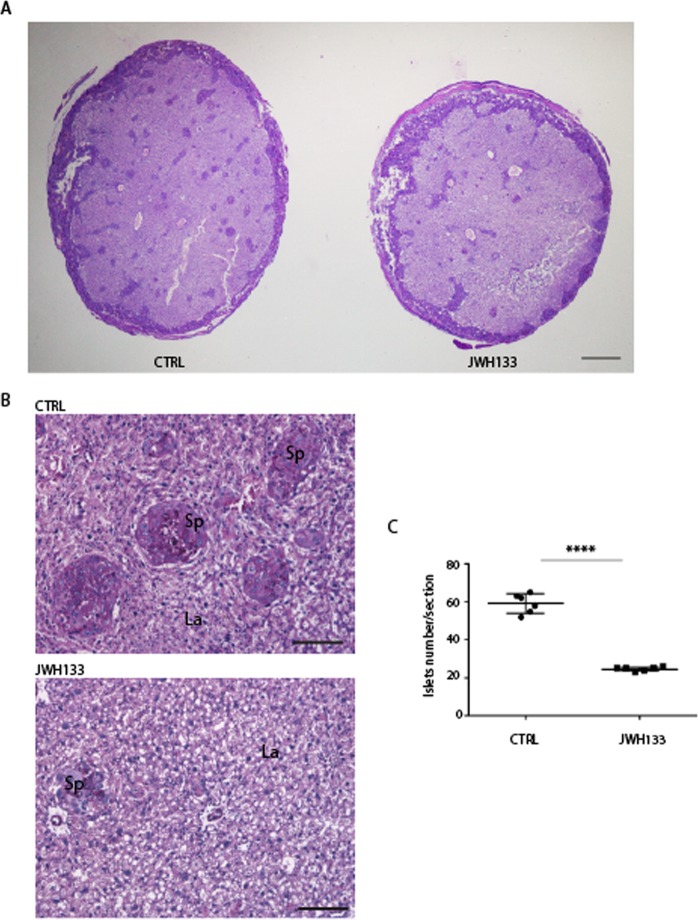 Reduced number of spongiotrophoblast islets in E18.5 placentas from JWH-133 father. (A) PAS staining of placenta cross-sections from CTRL and JWH-133 fathers. JWH-133 derived placenta is smaller than CTRL placenta. Glycogen cells are stained deep purple by PAS. A reduced number of glycogen cell islets within the labyrinth layer was observed in the placenta from JWH-133 father. This is consistent with the presence of a thinner and less invasive spongiotrophoblast layer. Scale bar: 1 mm. (B) Magnification view of the spongiotrophoblast islets. Scale bar: 100 µm. (C) Scatter plot of the number of islets/section showing the reduced number of islets in placenta from JWH-133 father (24.67 ± 1.03 in JWH-133 vs 59.17 ± 5.04 in CTRL). The number was counted by using five cross-sections for each placenta (n = 5) for each group. Error bars show SD. ****P < 0.0001.