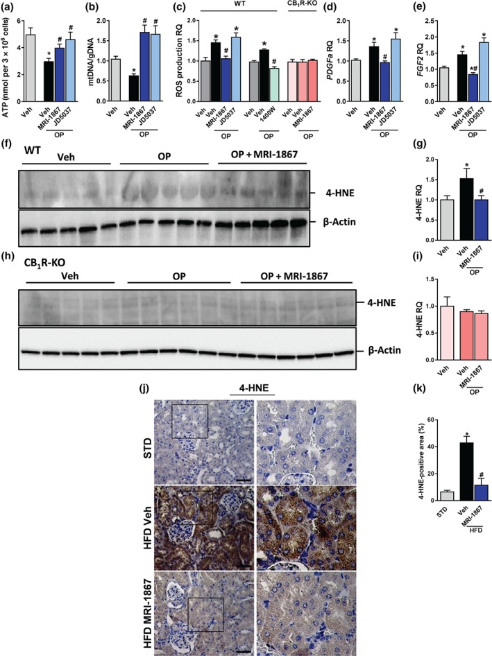 MRI‐1867 improves renal inflammation and fibrosis in diet‐induced obese mice. Mice on standard diet (STD) or high‐fat diet (HFD) for 18 weeks were treated with vehicle (Veh) or MRI‐1867 (3 mg·kg−1) orally for 28 days. The HFD‐induced up‐regulation in the renal mRNA and/or the protein expression levels of (a–c) collagen‐1, (a, b, d) CCL2, (a, b, e) inducible NOS (iNOS), and (a, b, f) tissue inhibitor of metalloproteinase 1 (TIMP‐1) were attenuated or normalized in the MRI‐1867‐treated DIO mice. Similarly, the elevated collagen deposition in Veh‐treated DIO mice, measured by (g, h) Sirius Red staining and (i, j) Masson's trichrome staining, was reversed by chronic MRI‐1867 treatment. Scale bar, 20 μm. RQ, relative quantitation. Data represent the mean ± SEM from 8 to 14 mice per group. * P < .05, significantly different from animals on STD; # P < .05, significantly different from animals on the same diet; one‐way ANOVA, followed by a Bonferroni post hoc test