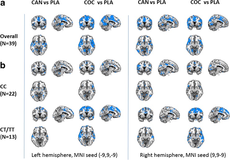 NAc related functional connectivity decrements following cannabis and cocaine in the left and right hemisphere, relative to placebo. Shown are thresholded (t = 2.34) Z-score maps of functional connectivity (a) averaged over DBH genotypes and (b) for individuals with CC and CT/TT genotypes separately (CAN = cannabis, COC = cocaine; left = left; planes are made at MNI seed position)