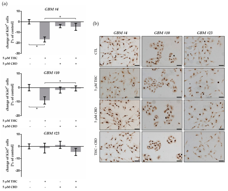 Impact of ∆9-tetrahydrocannabinol (THC) and cannabidiol (CBD) on proliferation capacity of human patient-derived GBM cells. (a) Effects of THC and CBD on the number of Ki67-labelled GBM cells. In comparison to control group, application of THC (5 µM) for 24 h produced a significant reduced number of Ki67+ cells in GBM #4 and GBM #10, but not in GBM #23. Alterations after treatment with CBD (5 µM) were not observed, but in combination with THC it reversed the effects of THC in GBM #4 and GBM #10. Data are means ± SEM of N = 3 independent experiments performed in duplicate. Significance was chosen for p < 0.05. The asterisk denotes significant results regarding the respective measurement indicated with the bar. (b) Representative images of Ki67-immunoreactive GBM cells (Ki67+ in brown and Ki67- in blue) untreated (CTL) or treated with THC (5 µM), CBD (5 µM), and an equimolar combination of THC and CBD after 24 h. Nuclei were counterstained using hematoxylin. Scale bar = 75 µm.