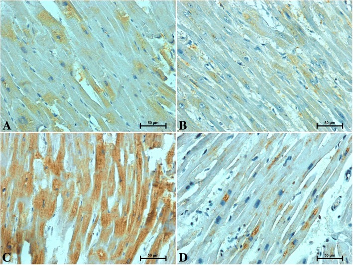 Immunohistochemical reaction determining S100A6 in the heart of patients under 50 years old a men b women and over 50 years old c men d women