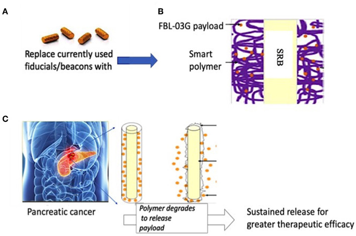 Illustration of pancreatic therapy approach using non-cannabinoid cannabis derivative, FBL-03G. (A) Currently used commercially-available inert radiotherapy biomaterials e.g., fiducial (CIVCO Medical)/beacons used during radiotherapy to ensure geometric accuracy (B) smart radiotherapy biomaterials (SRB) with FDA approved polymer component loaded with FBL-03G; (C) potential clinical translation pathway is envisioned where the SRBs could simply replace the inert biomaterials (in A). Such replacement would come at no additional inconvenience to cancer patients. Once in place the SRBs can be activated by tumor microenvironment to sustainably release FLB-03G as the polymer component degrades for greater effective tumor cell kill, potentially with or without radiotherapy.