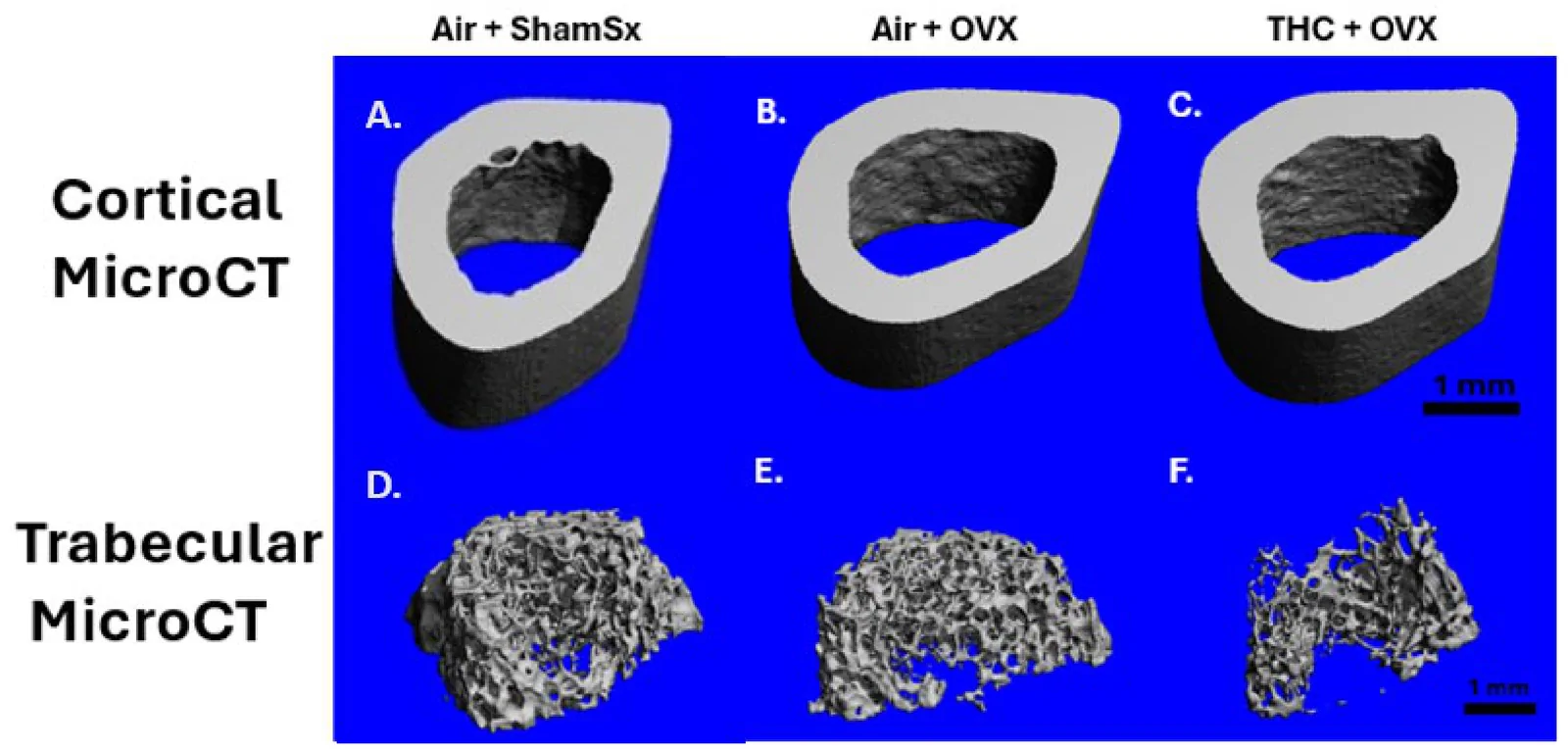 Surface-rendered microCT images. Representative series of femoral microCT images of mid-diaphyseal cortical regions of interest from: (A) Air + ShamSx; (B) Air + OVX; (C) THC + OVX; and proximal metaphyseal trabecular regions of interest from (D) Air + ShamSx; (E) Air + OVX; (F) THC + OVX. Scale bar represents 1 mm.