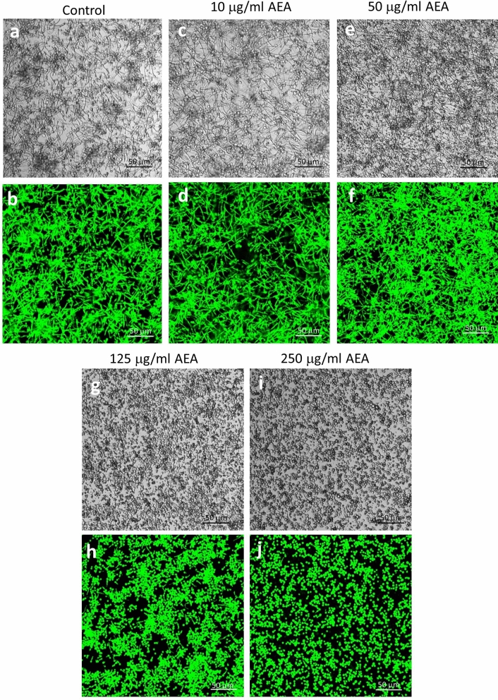 Anandamide prevents yeast-hypha transition. GFP-expressing Candida albicans taken from PDA plates in its yeast form was incubated with different concentrations of AEA at 37 °C for 4 h, and the morphology studied by confocal microscopy. (a, c, e, g, i) Bright field. (b, d, f, h, j) green fluorescence.