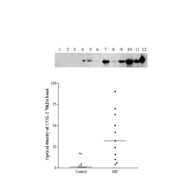 Top panel, representative Western blots of the COX-2 70 kDa band in control (lanes 1–6) and MS (lanes 7 – 11), and lane 12 mouse macrophage positive control. Bottom panel, optical density analysis of COX-2 Western blots. Relative optical density readings of COX-2, 70-kDa bands in the spinal cord of controls compared to MS specimens.