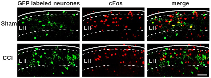 c-Fos expression in GABAergic neurons.Upper row: c-Fos expression after noxious heat stimulus in a sham-treated mouse colocalizes with EGFP-labeled GABAergic neurons. Lower row: In a CCI-operated mouse c-Fos can be detected in fewer EGFP-labeled neurons as compared to a sham-treated mouse. (scale bar: 50 µm, left = lateral, right = medial) Border between dorsal horn and white matter is indicated by a solid line, lamina borders by a dashed line. Lamina II is indicated by L II.