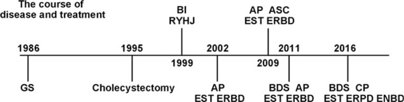 Schematic diagram shows the chronicle of disease course and treatment. AP = acute pancreatitis, ASC = acute suppurative cholangitis, BDS = bile duct stone, BI = biliary infection, CP = chronic pancreatitis, ENBD = endoscopic nasobiliary drainage, ERBD = endoscopic retrograde biliary drainage, ERPD = endoscopic retrograde pancreatic drainage, EST = endoscopic sphincterotomy, GS = gallbladder stone, RYHJ = Roux-en-Y hepaticojejunostomy.