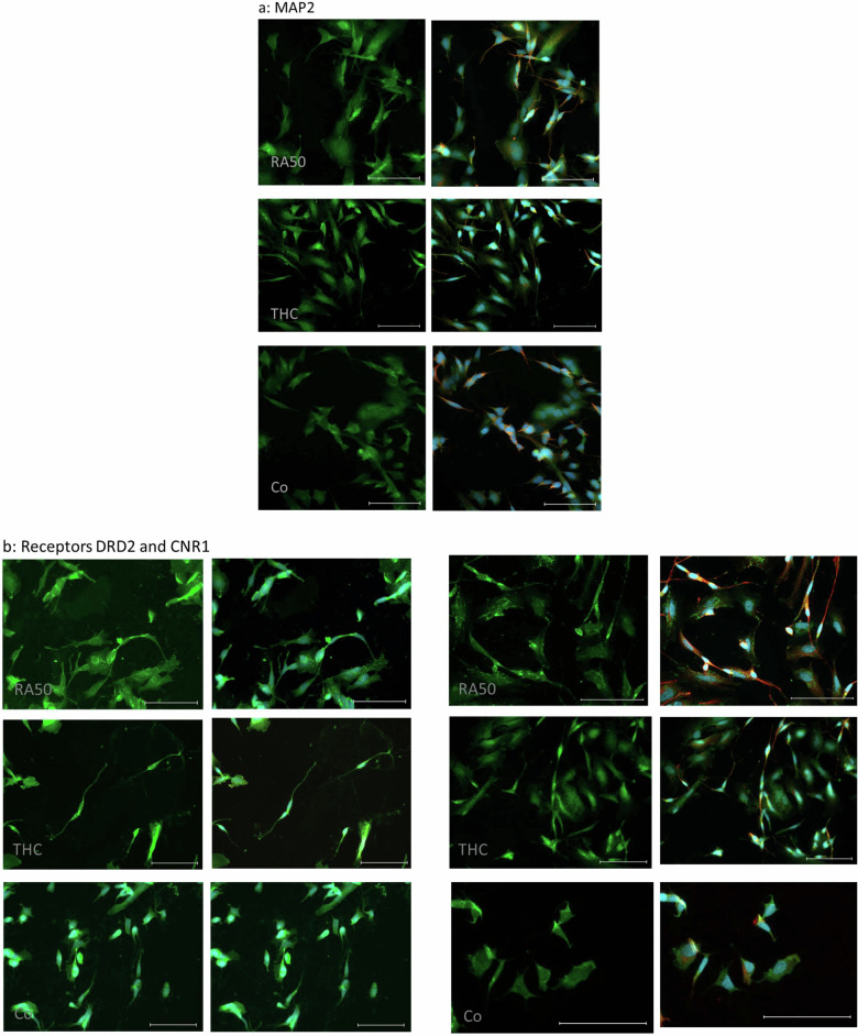 ICC of target molecules.a ICC of MAP2 in differentiated cells, THC-treated cells, and undifferentiated control cells. On the left side, sole MAP2-staining (green) is presented, whereas, on the right side, the corresponding merge pictures of the co-staining with TUBB3 (βIII-Tubulin) (red) and nuclei (blue) are depicted. The scale bar represents 100 µm. b ICC of DRD2 (left panel) and CNR1 (right panel) in differentiated cells, THC-treated cells and undifferentiated control cells. In the respective left column sole DRD2- and CNR1-, staining (green) is presented, whereas, in the right column, the corresponding merge pictures of the co-staining with TUBB3 (βIII-Tubulin) (red) and nuclei (blue) are depicted. Unfortunately, in the case of the DRD2 staining TUBB3 has not been stained for practical reasons. Scale bar: 100 µm. c ICC of Grik (left panel) and GRIN1 (NMDAR1) (right panel) in differentiated cells, THC-treated cells, and undifferentiated control cells. In the respective left column sole Grik- and GRIN-, respectively, staining (green) is presented, whereas, in the right column, the corresponding merge pictures of the co-staining with TUBB3 (βIII-Tubulin) (red) and nuclei (blue) is depicted. The scale bar represents 100 µm. d ICC of SYP (left panel) and DLG4 (PSD95) (right panel) in differentiated cells, THC-treated cells, and undifferentiated control cells. In the respective left column, sole SYP- and DLG4-staining (green) is presented, whereas, in the right column, the corresponding merge pictures of the co-staining with βIII-Tubulin (red) and nuclei (blue) is depicted. The Scale bar represents 100 µm.