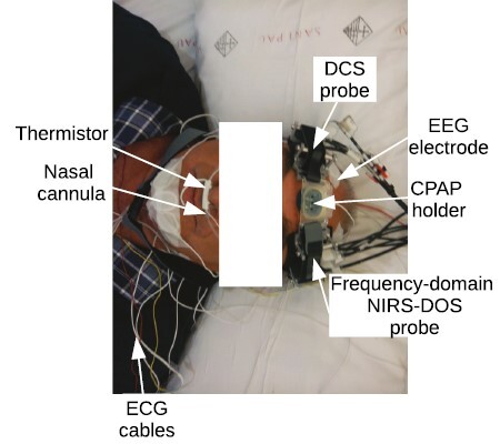 The optical probes for each technique and the polysomnographic sensors that are placed on the subject’s head. DCS, diffuse correlation spectroscopy; EEG, electroencephalography; CPAP, continuous positive airway pressure; NIRS-DOS, near-infrared diffuse optical spectroscopy; ECG, electrocardiography.