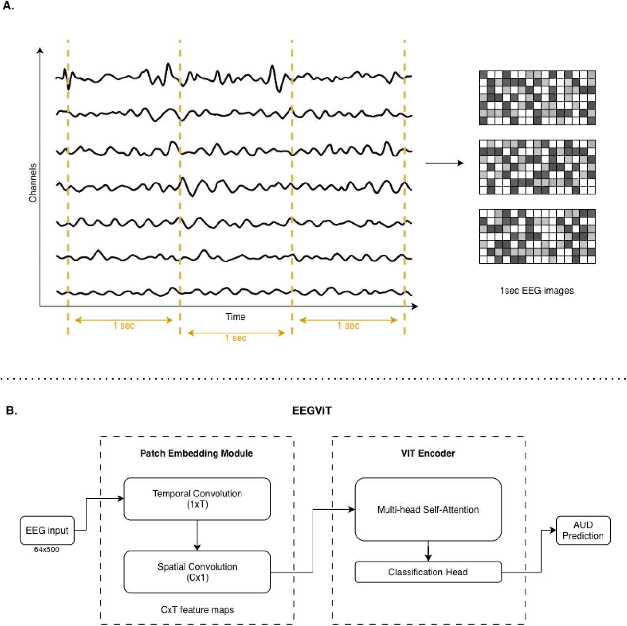 Epoching and the EEGViT model architecture. A. The EEG signal is divided into 1-second non-overlapping epochs. These one-second epochs serve as input to the model as images. B. The model consists of a patch embedding module that applies temporal and spatial convolutions to the raw EEG signal, followed by a Vision Transformer (ViT) encoder pretrained on ImageNet. The output is then passed through a classification head to predict AUD.