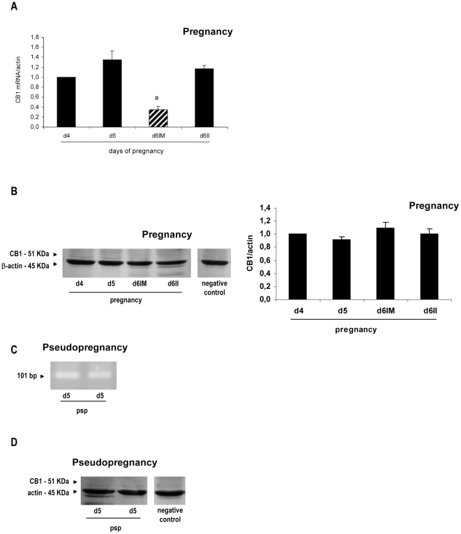 Expression of cannabinoid receptor type-1 at implantation and pseudopregnancy.Cannabinoid receptor type-1 (CB1) messenger (A and C) and protein (B and D) were detected during peri-implantation (A and B) and on day 5 of pseudopregnancy (C and D). Results are shown as means ± S.E.M. N = 4–6 for each point. a: p<0.001 vs the rest. d4: day 4, d5: day 5, d6: day 6, IM: implantation sites, II: inter-implantation sites, psp: pseudopregnancy.