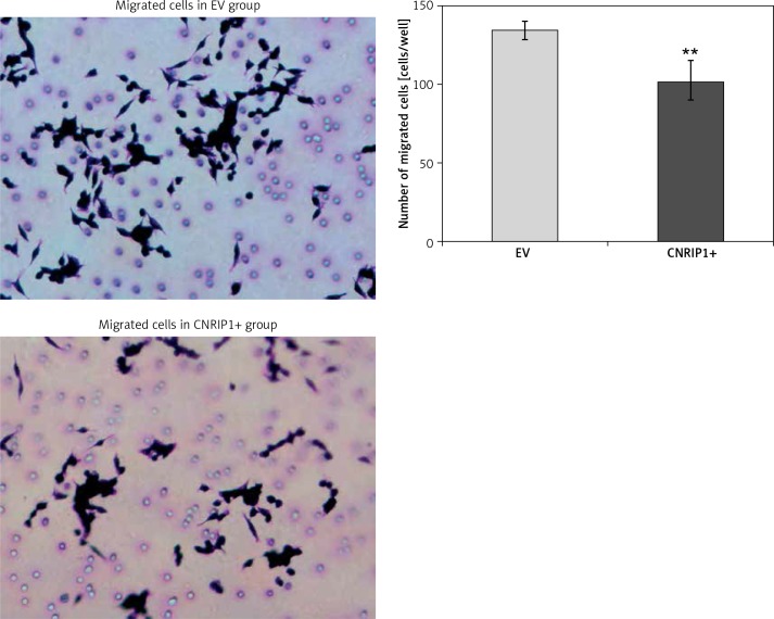 Migration of colon cancer cells transfected with a CNRIP1-overexpression plasmid. Transfection of SW620 cells with a CNRIP1-overexpression plasmid significantly reduced their migration ability (101.5 ±13.89 cells/well) when compared to the migration ability of SW620 colon cancer cells transfected with an empty vector (134.33 ±5.72 cells/well; t = 5.126, p = 0.004)**p < 0.01 (CNRIP1+ vs. EV).